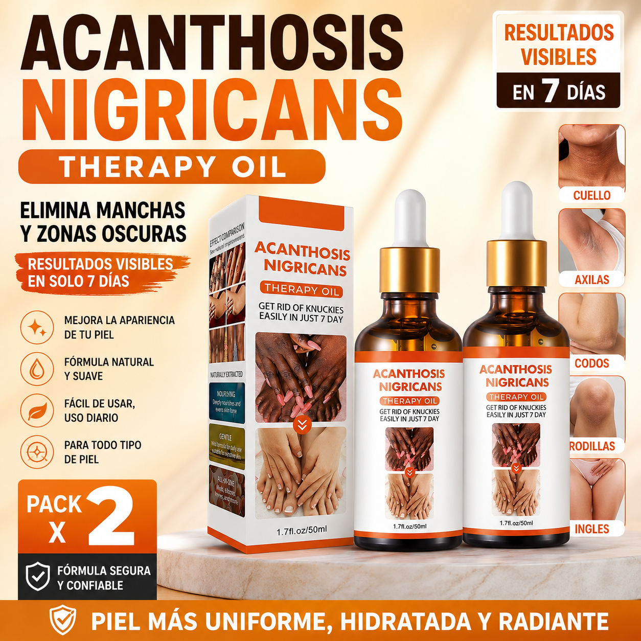 Acanthosis Nigrican - Serum aclarante