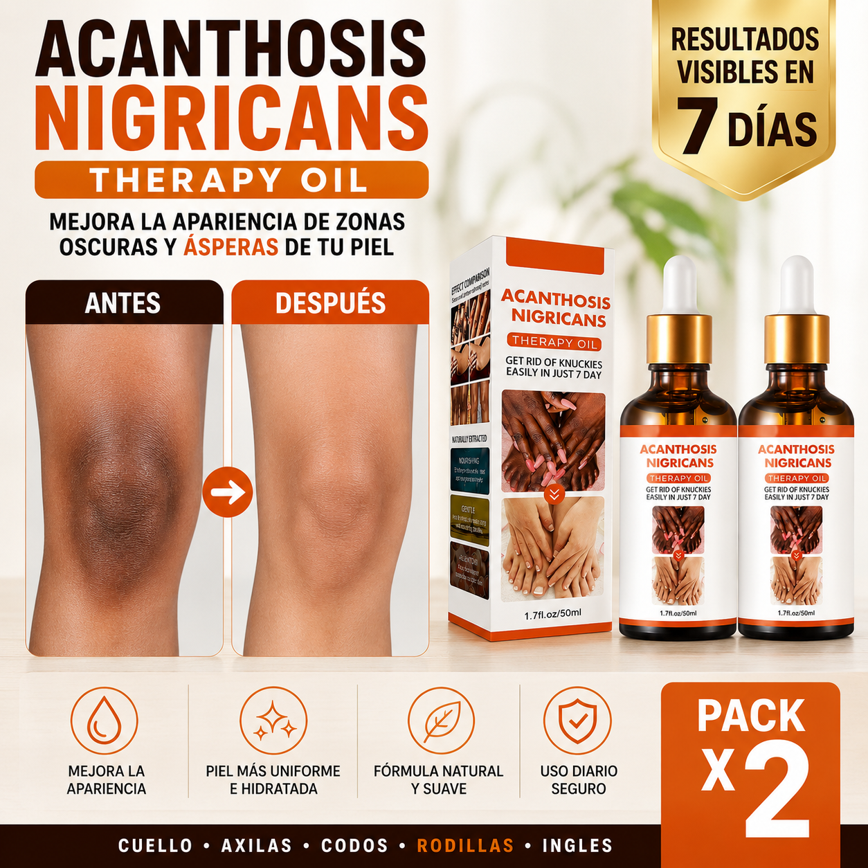 Acanthosis Nigrican - Serum aclarante